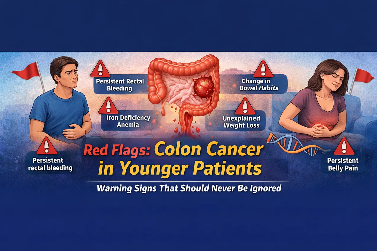 Red Flags Colon Cancer